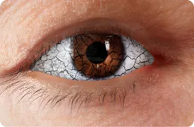 Artistic rendering of dry, gritty eyes caused by Thyroid Eye Disease