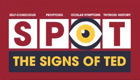 Thyroid Eye Disease mnemonic thumbnail